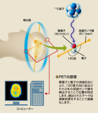 PETの原理